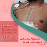 درمان انواع بیماری قلبی از روش جراحی قلب باز