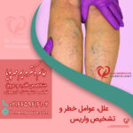 علل، عوامل خطر و تشخیص واریس